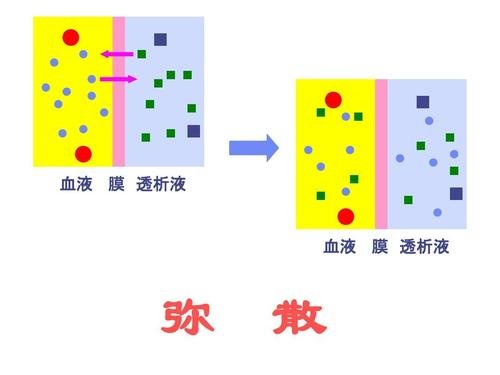 血液透析液 血液透析液